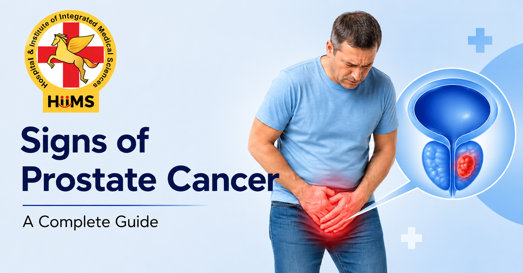 What Are the Signs of Prostate Cancer? A Complete Guide